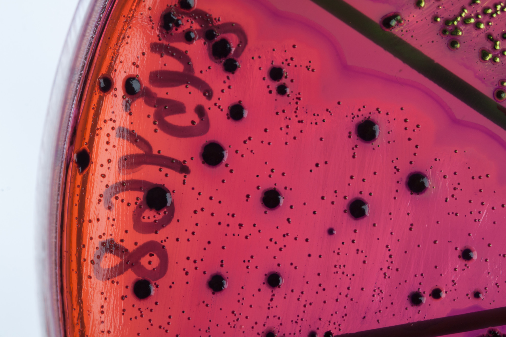 agar analysis of bacteria