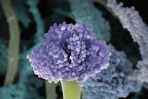 Microscopic view of a fungal specimen