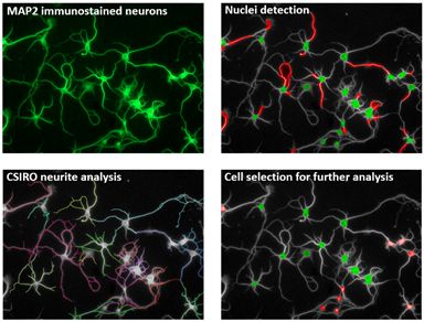 Automated rat cortical neuron neurite outgrowth analysis using CSIRO algorithm.