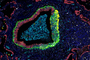 photo of lab tech in protective gear