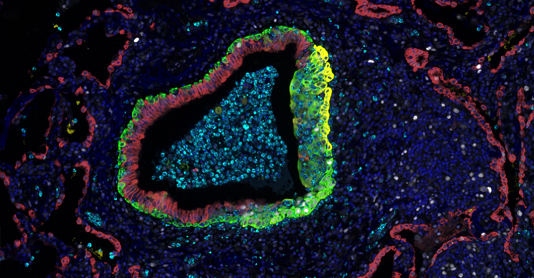 selected cell phenotypes and tissue architecture in a lung tumor section in a high-plex assay