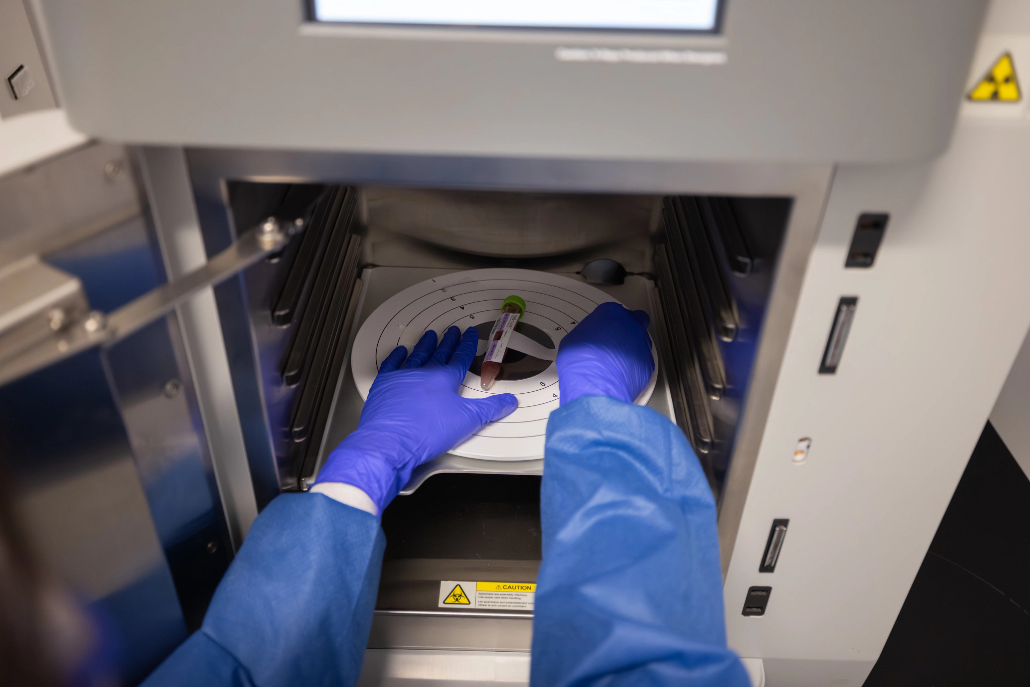 cryopreserved irradiated PBMCs