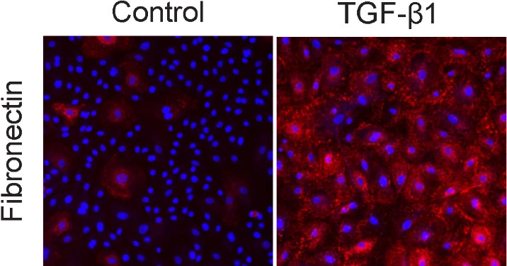 The image shown is from the Epithelial-to-Mesenchymal Transition (EMT) Assay. It is showing the levels of fibronectin with high content imaging. On the left is the control, and on the right is the fibronectin levels induced by TGF-β1.