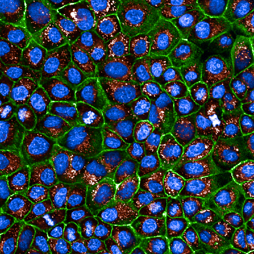 High-content imaging readout showing lysosomal trapping of Lysotracker Red dye (red fluorescence) in MDCKII cells with nuclei stained blue and cell membranes green.