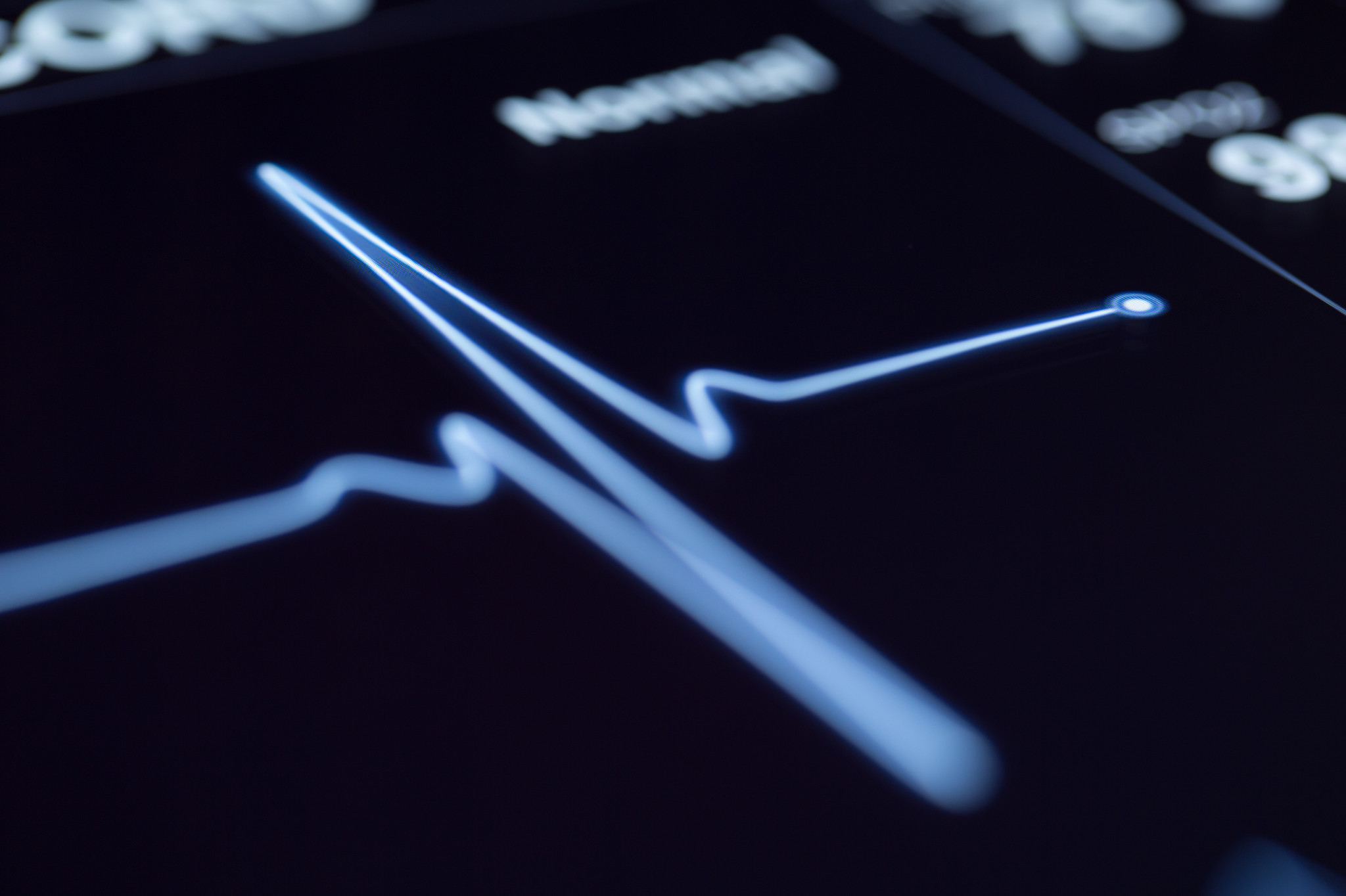Computer monitor showing heart beat graphic.