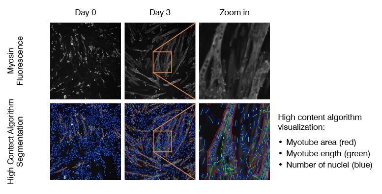 Myoblast to myotube differentiation