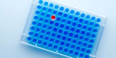 Multiplex assay plate showing simultaneous detection of multiple cytokines in a single sample.