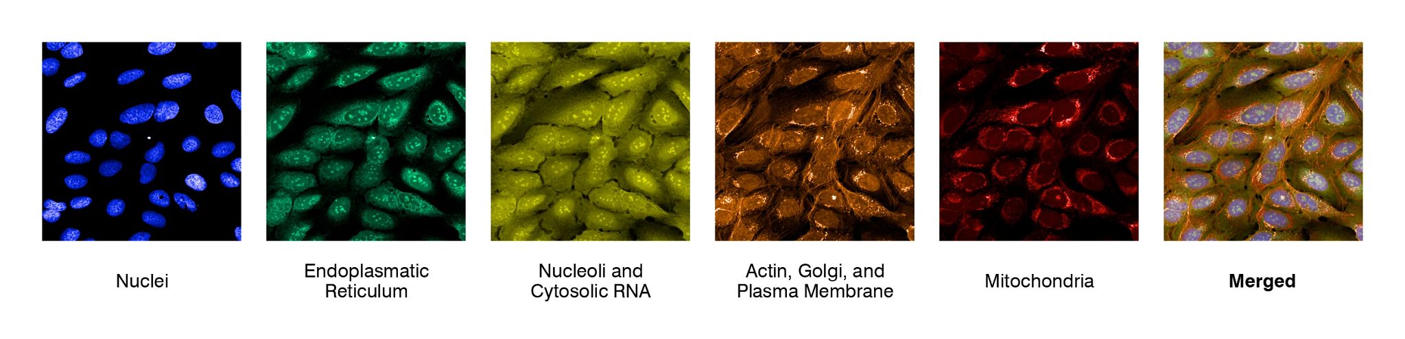 Cell Painting in the U-2 OS osteosarcoma cell line