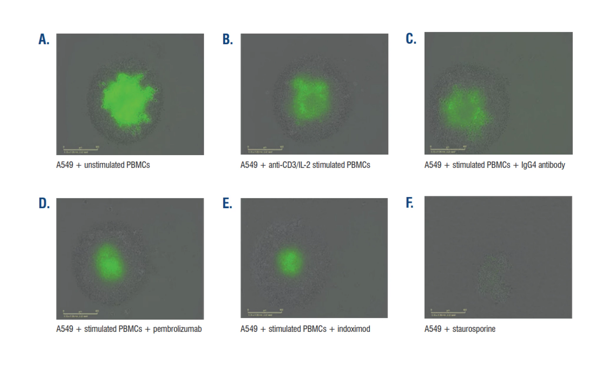 Representative data is shown below from one donor with 10 ng/mL anti-CD3 and 10 ng/mL IL-2 stimulation scanned every four hours post stimulation for five days.