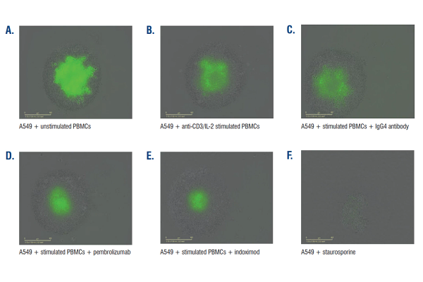 Representative data is shown below from one donor with 10 ng/mL anti-CD3 and 10 ng/mL IL-2 stimulation scanned every four hours post stimulation for five days.