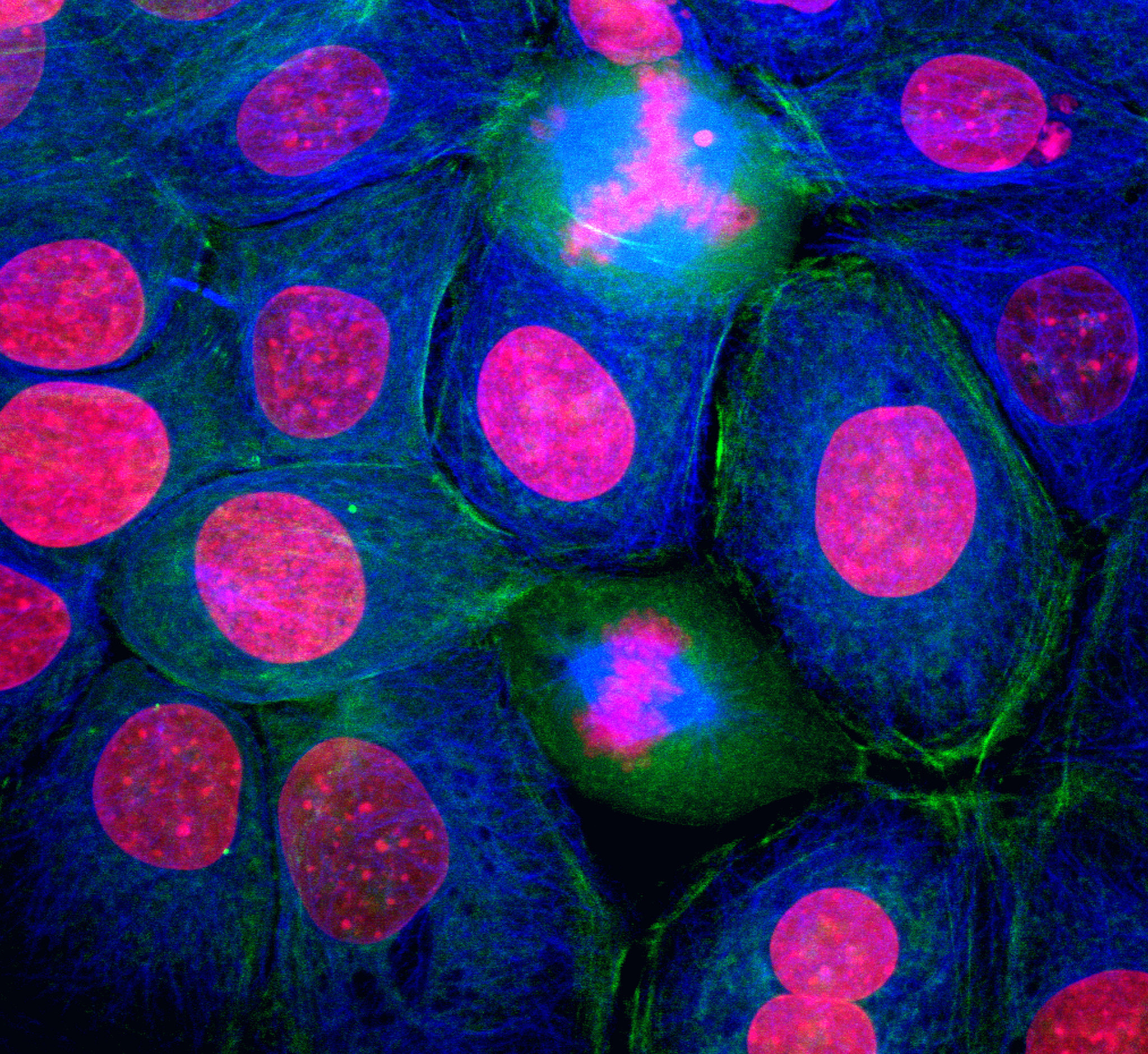 inar In Vivo Modeling of Breast Cancer Dissemination with the SRG