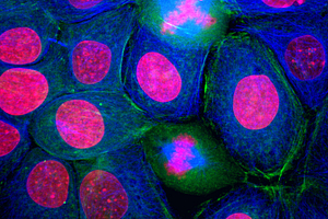 Cancer model database