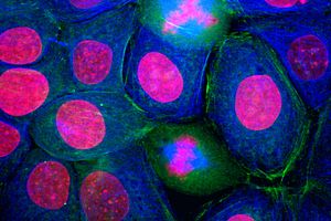 Image of cancer cells.