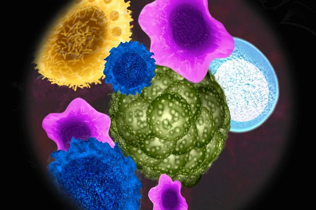 Graphic image of tumor cells being viewed under a microscope to represent the oncology analysis methods and endpoint services offered at Charles River.