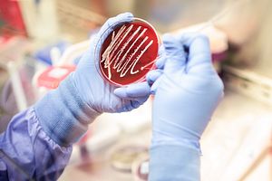 Gloved hands holding an agar plate and collecting a sample of the organism