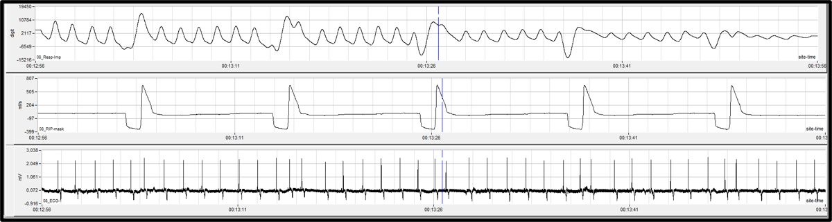 An Innovative Assessment of Respiratory Function in Safety Pharmacology ...