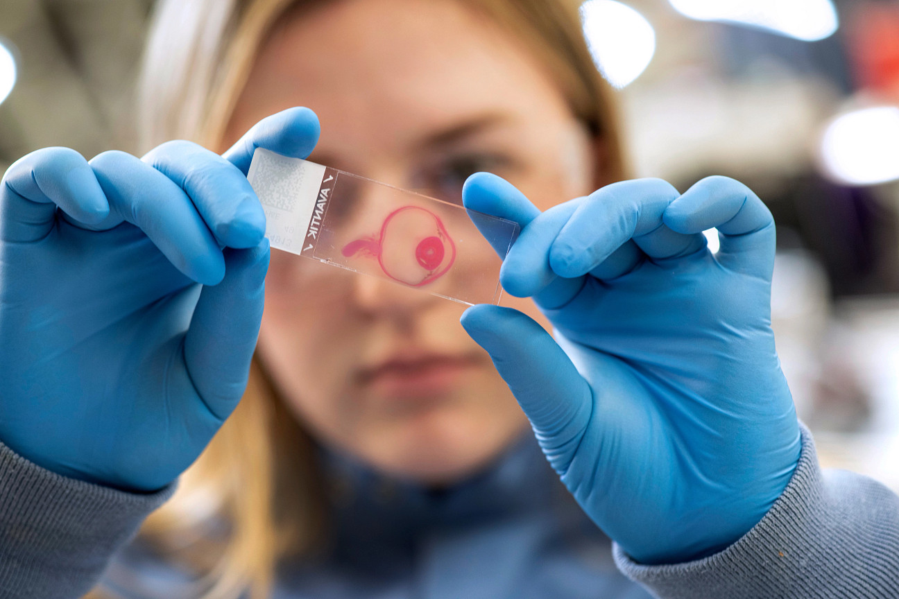 Charles River lab technician wearing blue coat looking at image of histopathology of eye slide in a close-up image. 