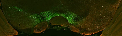 Green and red graph showing TH-positive cells for Alpha-synuclein Immunoreactivity in the AAV-A53T Alpha-synuclein Model.