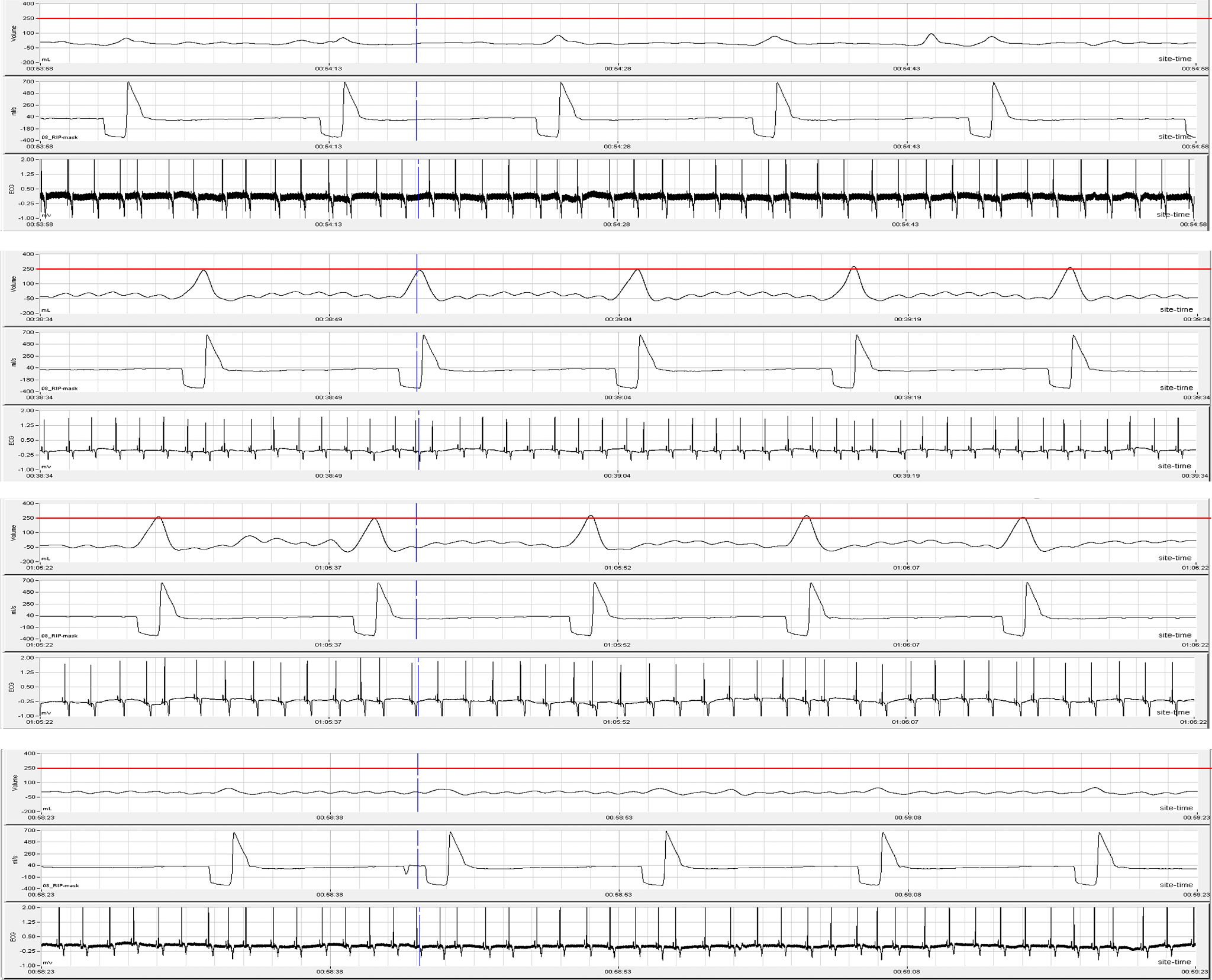An Innovative Assessment of Respiratory Function in Safety Pharmacology ...
