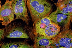 Image taken from cell painting assay