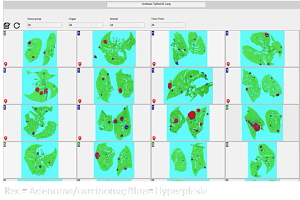 Digital Pathology slides with Patholytix
