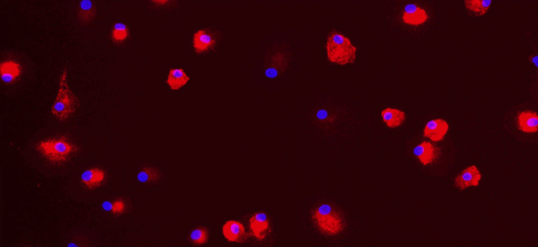 Red fluorescent dots on a black background. This image is a high content image taken from the in vitro M2 Polarization Fibrosis assay at Charles River.