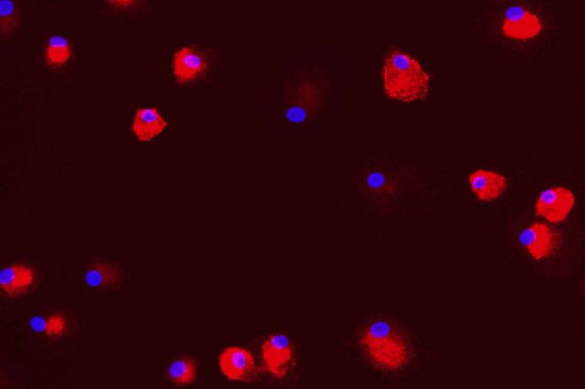 Red fluorescent dots on a black background. This image is a high content image taken from the in vitro M2 Polarization Fibrosis assay at Charles River.