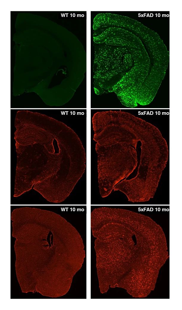 Biomarker analysis in 5xFA mouse model