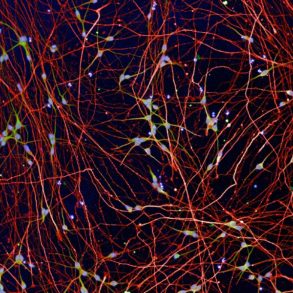 Human cortical neurons stained for nuclei (Dapi, blue), MAP2 (green), BetaIII tubulin (red)
