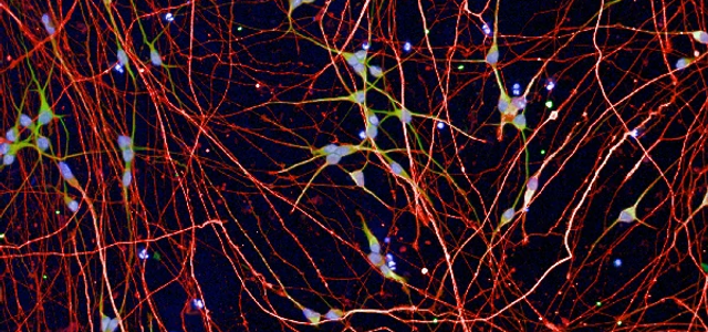 Human cortical neurons stained for nuclei (Dapi, blue), MAP2 (green), BetaIII tubulin (red)