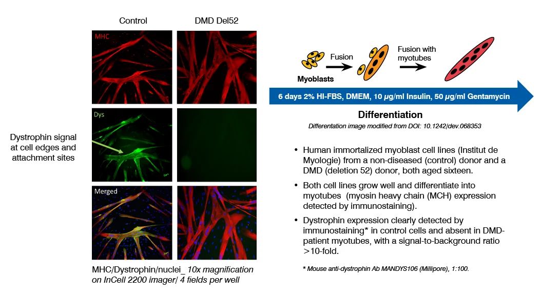 Dystrophin expression in control and DMD patient myotubes