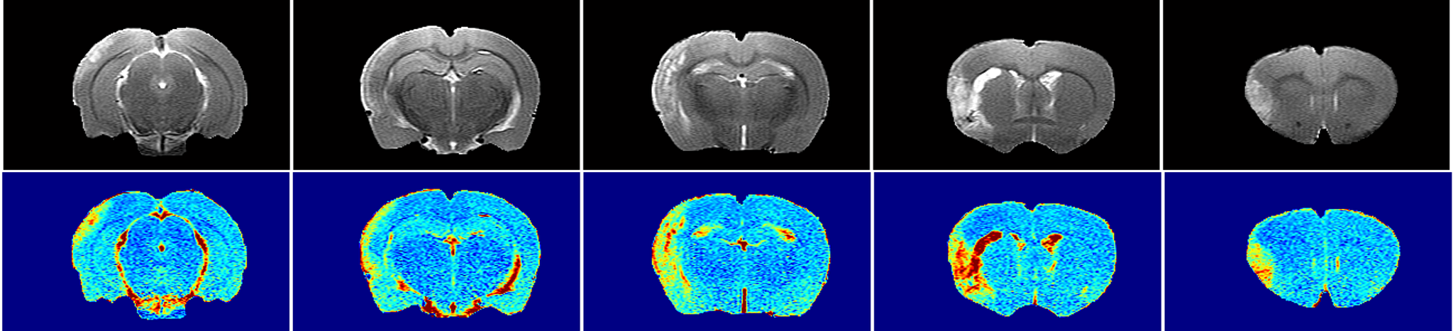 MRI scans showing detection and quantification of lesion size 24 hours post pMCAO surgery in SHRs (top row) and quantitative mapping of T2-relaxation time as a marker of tissue viability (bottom row).
