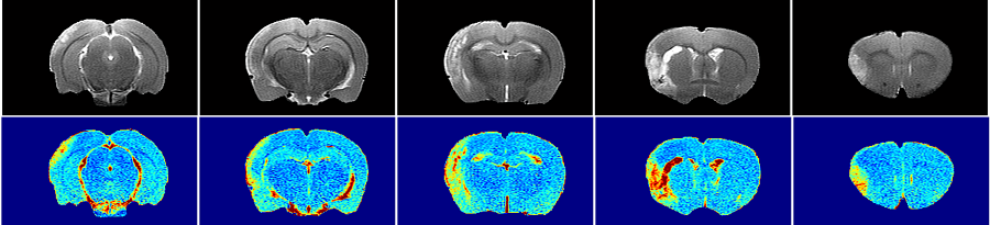 MRI scans showing detection and quantification of lesion size 24 hours post pMCAO surgery in SHRs (top row) and quantitative mapping of T2-relaxation time as a marker of tissue viability (bottom row).