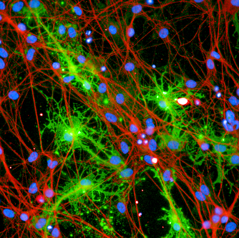 neurons (red, beta3 tubulin) and oligodendrocytes (MBP, green)