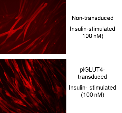 Glut4 translocation