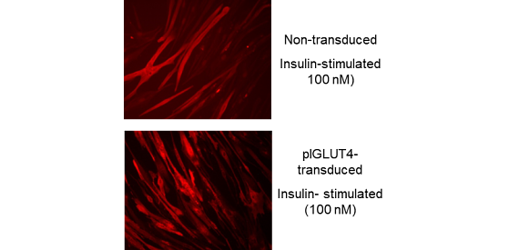 Glut4 translocation