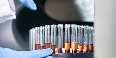 Immunophenotyping Marie-Solie