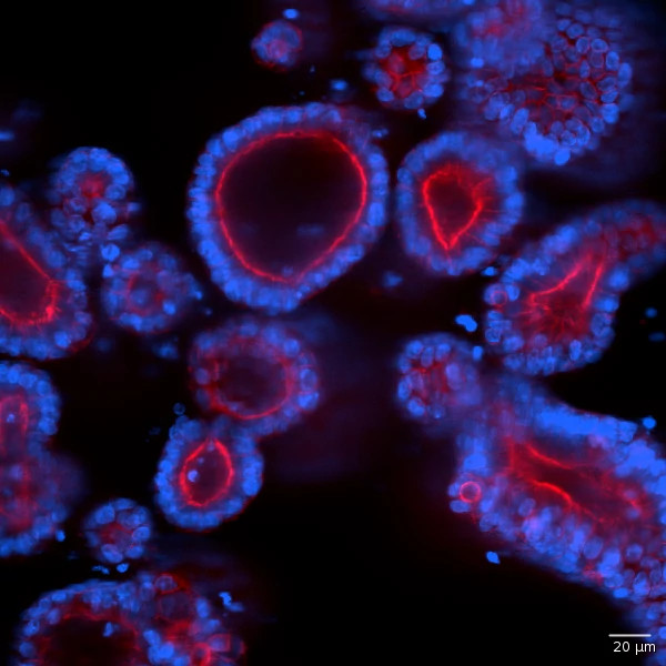 Celluar Morphology of Human Intestinal Organoid
