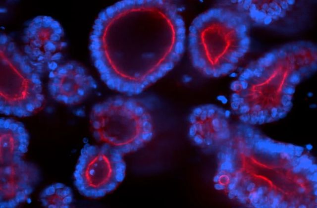 Monoclonal antibodies