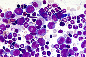 Fluid Based Biomarkers during immunology research