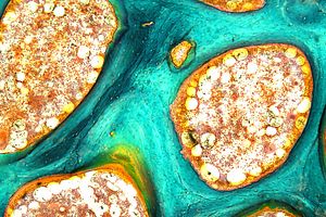 Bone Research On-demand