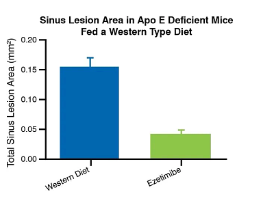 Bar chart on the right showing sinus lesion area in Apo E deficient mice fed a western type diet.
