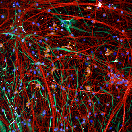 Multi-cell culture model of neurons (red, MAP2), microglia (yellow, IBA1) and astrocytes (green, GFAP), blue = dapi