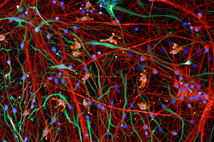 Multi-cell culture model of neurons (red, MAP2), microglia (yellow, IBA1) and astrocytes (green, GFAP), blue = dapi