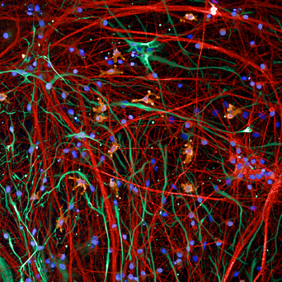 neurons (red, MAP2), microglia (yellow, IBA1), and astrocytes (green, GFAP)