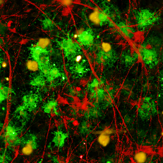 Cell culture models immunofluorescent staining showing neurons (red, MAP2), oligodendrocytes (green, MBP), and microglia (yellow, IBA1) in co-culture.