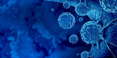 In vitro assays from PDX models
