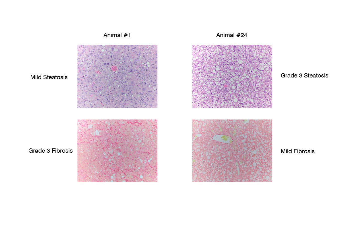 Four histology images of liver biopsies showing the varying degrees of steatosis and fibrosis in animals prior to initiation of treatment for the NASH Mouse Model 
