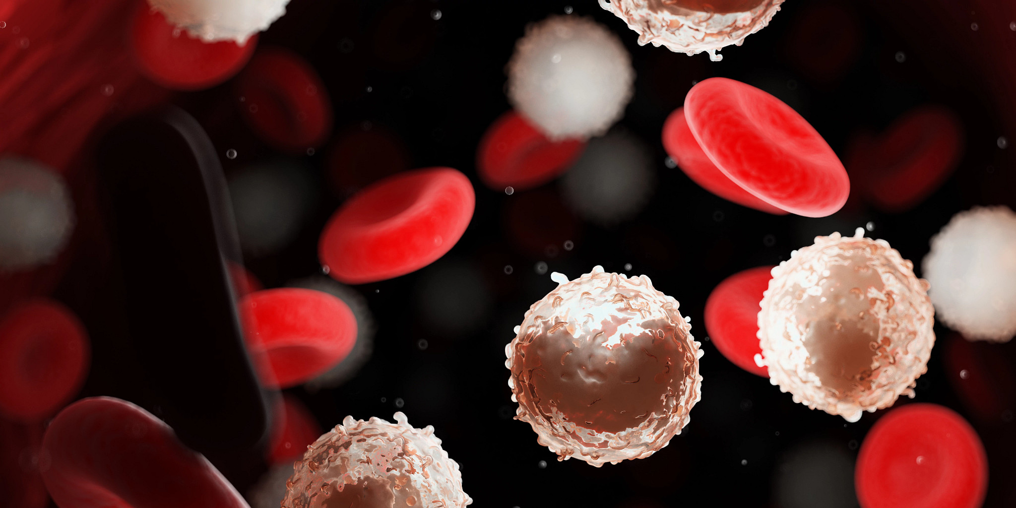 PBMC flow cytometry panels to evaluate the impact of cancer therapies that address cancers like leukemia described in this rendering of too many white blood cells.