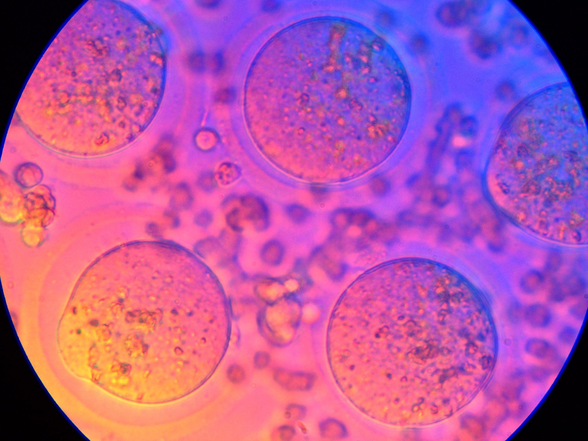 Microscope view of cells for the microbial control of cell and gene therapy products